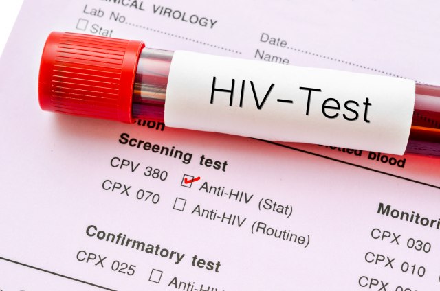Kineski naučnici tvrde da su blizu pronalaska leka za HIV
